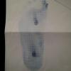 empreinte pied plat enfant