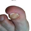 ongle-fraise.jpg