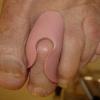 orthoplastie-protection-cor-1.jpg