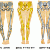 pathologies-genou.gif