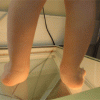 pied-plat-valgus-enfant.gif