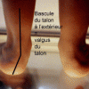 pied-valgus.gif